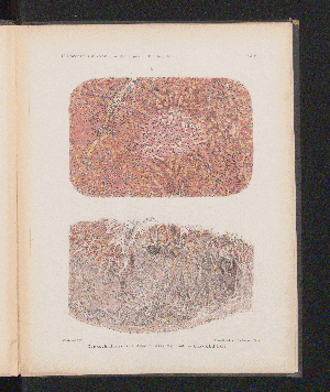 Vorschaubild von [[Über die Beulenpest in Bombay im Jahre 1897]]